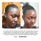 Noirélle Hair Growth Serum | 1 + 1 FREE