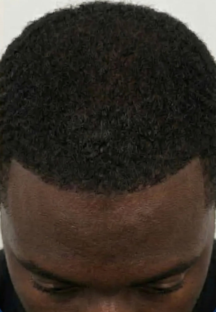 After